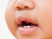 So, about those&nbsp;teeth…